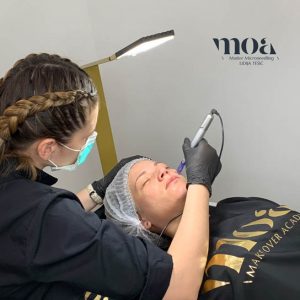 Microneedling Moa academy Microneedling Moa academy