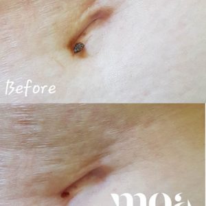 Plazma pen Moa academy